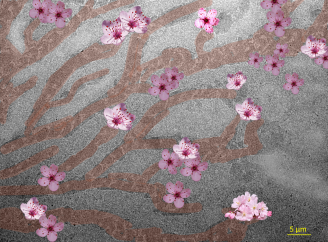 Sakura on TEM Grid